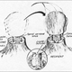 illustration of head transplant in monkey